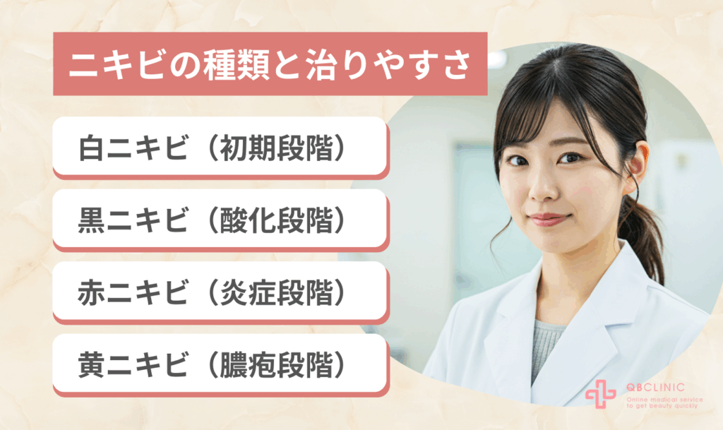 ニキビの種類と治りやすさ